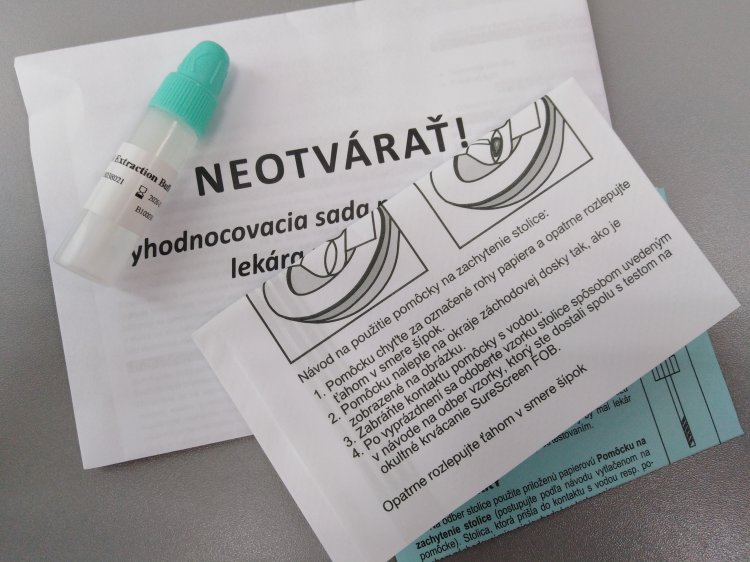 Test na skryté krvácanie v stolici môže odhaliť včasné štádium rakoviny. FOTO: preventivne.sk
