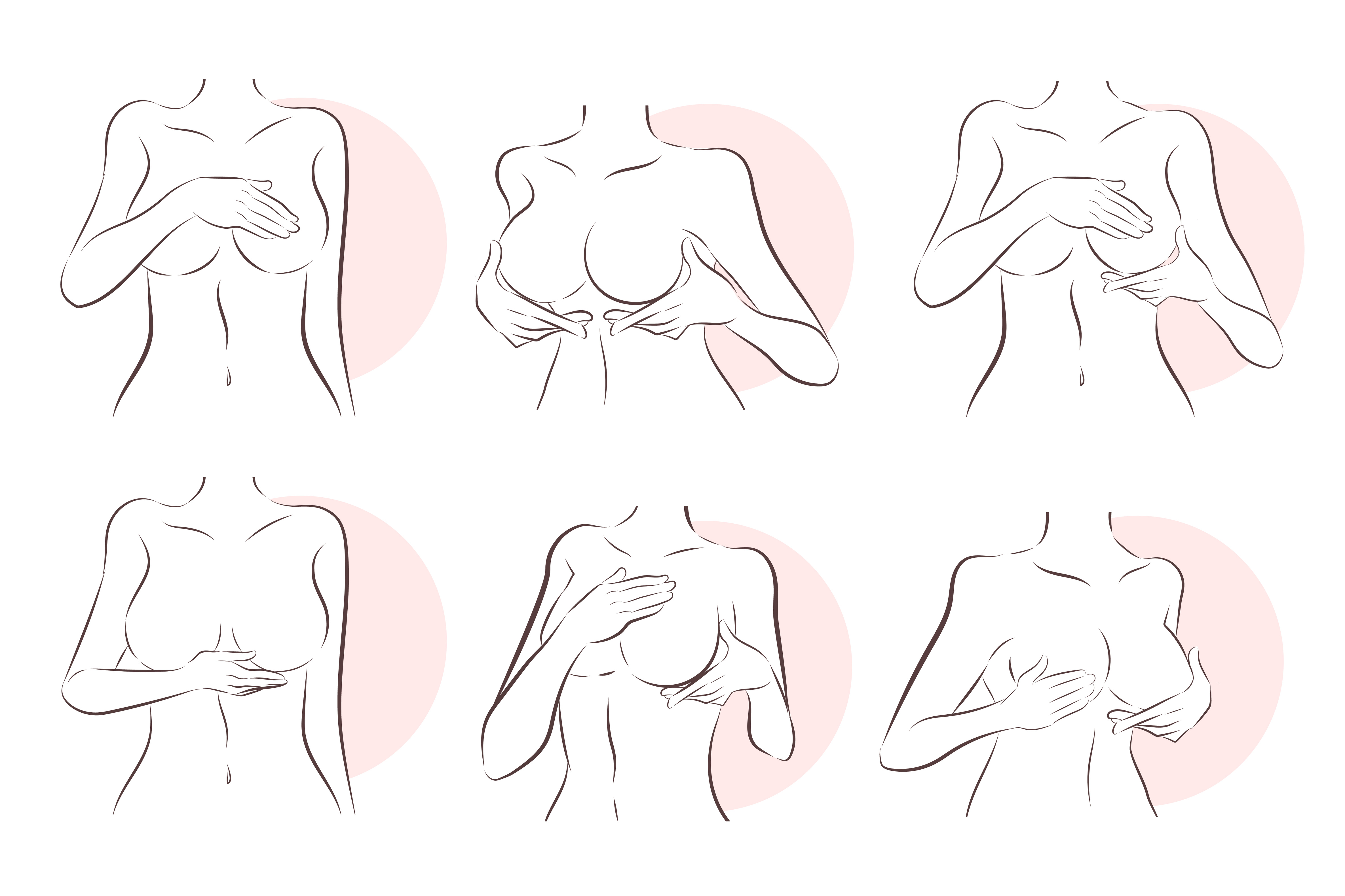 Samovyšetrovanie prsníkov dokáže odhaliť hrčku už vo veľkosti 1 cm. FOTO: Adobe Stock