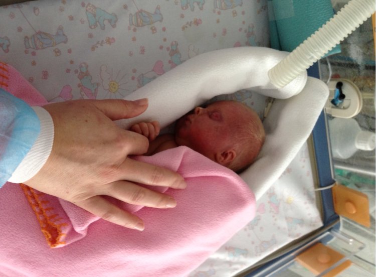 Krátko po narodení bojovala o život. FOTO: www.preventivne.sk