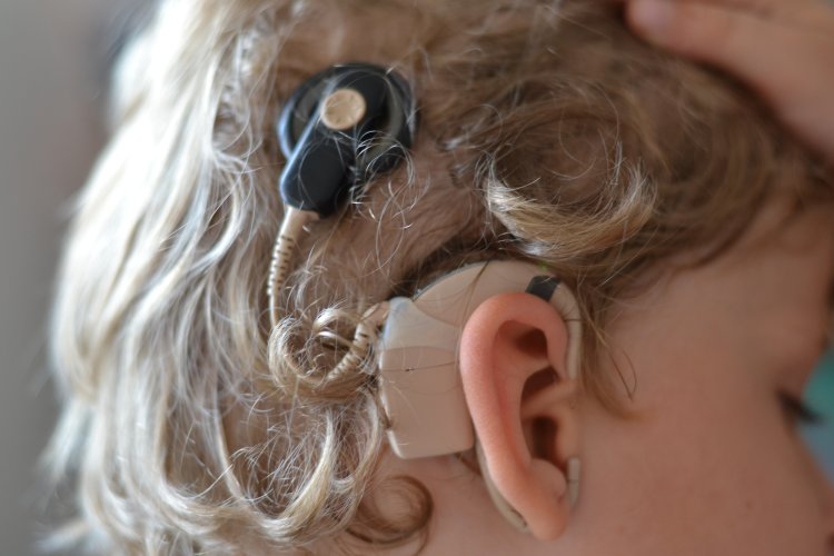Cena za implantát je približne 23-tisíc eur. FOTO: www.preventivne.sk