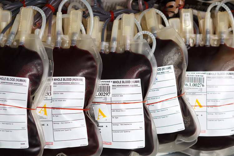 Krv sa spracúva a vyrábajú sa z nej takzvané transfúzne lieky. FOTO: Adobe Stock