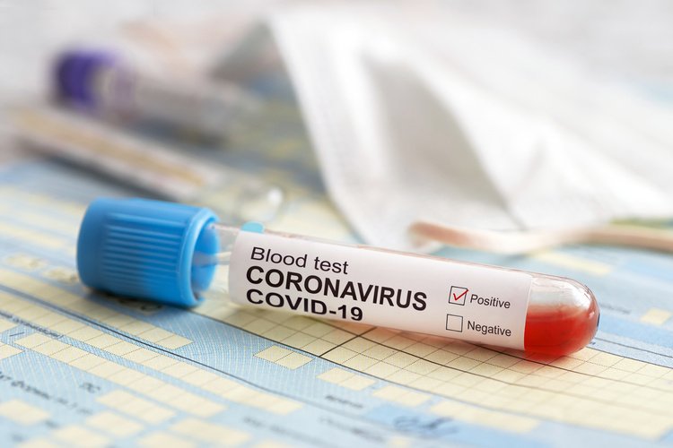 Odobratá krv sa netestuje na prítomnosť koronavírusu. Jeho prenos krvou nebol dokázaný. FOTO: Adobe Stock