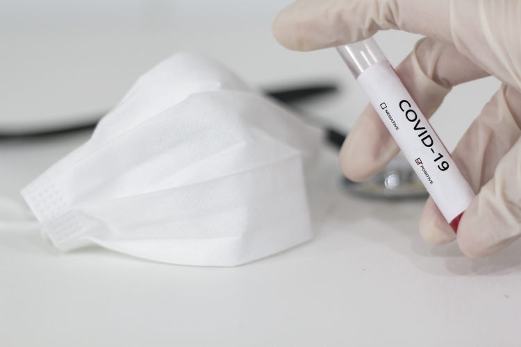 Ochorenie COVID-19 môže spôsobovať závažné komplikácie. FOTO: Adobe Stock