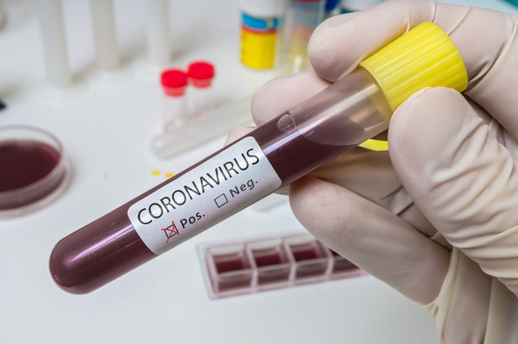 Nie každý reaguje na prítomnosť koronavírusu rovnako. Záleží aj od genetiky. FOTO: Adobe Stock