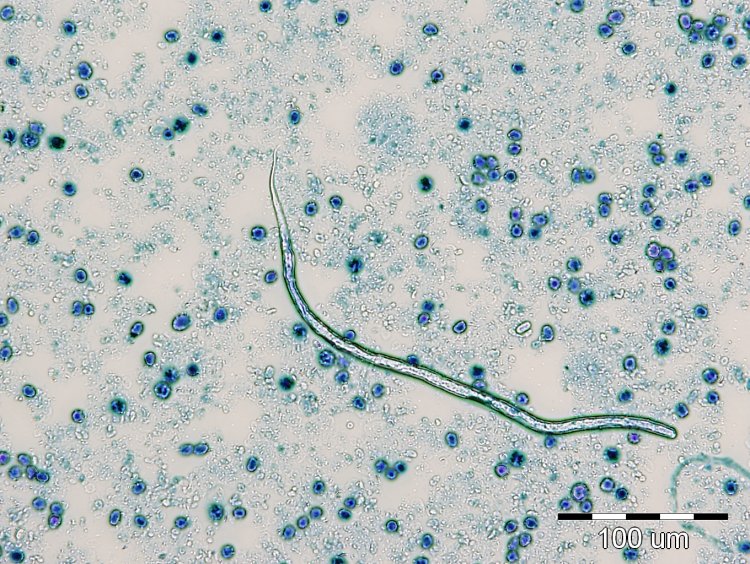 Mikrofilária sa dá u psa diagnostikovať z krvi. FOTO: Archív M.M.